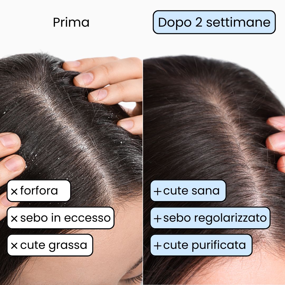 Set Solido Capelli Grassi – Purifica Senza Seccare