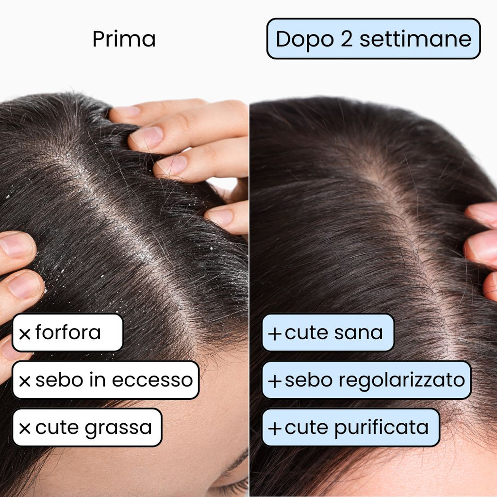 Shampoo Solido Purificante per capelli Grassi