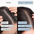 Shampoo Solido Purificante per capelli Grassi