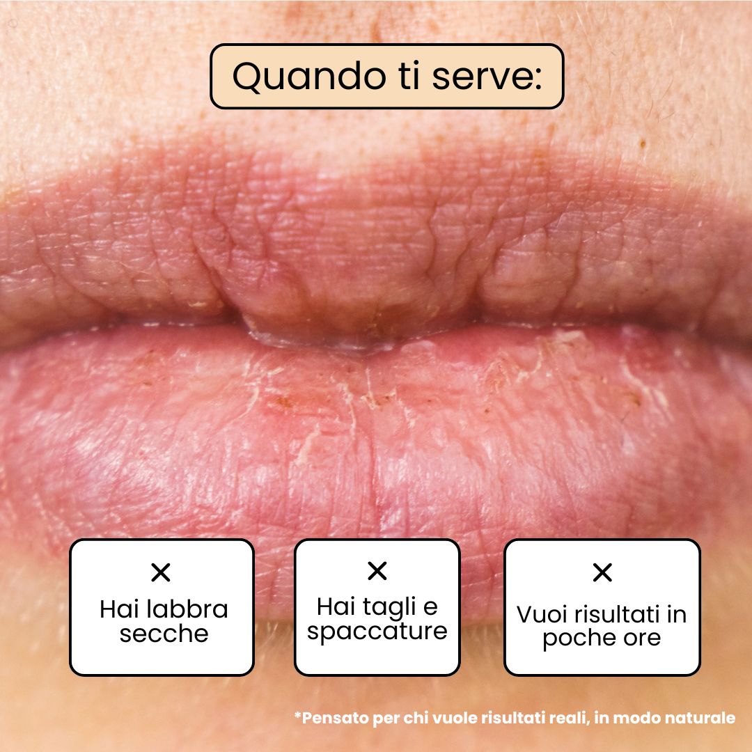 Balsamo Labbra VANILLA - Vaniglia